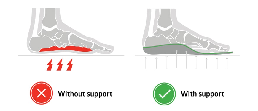 supportive insoles distribute pressure evenly in the foot