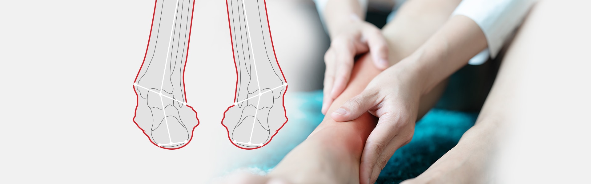 Supination and Pronation: What It Means for the Foot and Arm