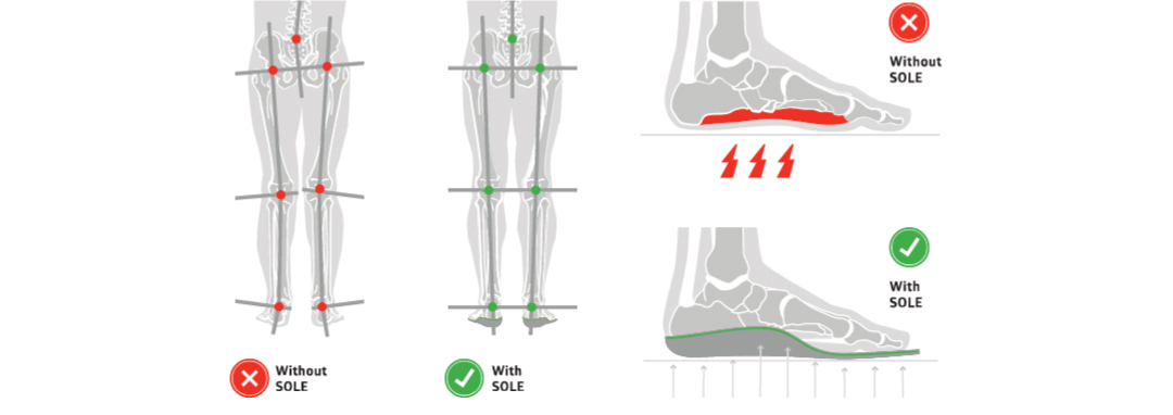 Most Of Our Customers Come On Feet >> The Lightest Tread Foot Health The Unsung Hero Of Whole Body Most Of Our Customers Come On Feet >> The Lightest Tread Foot Health The Unsung Hero Of Whole Body