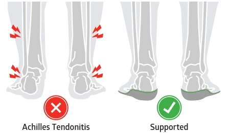 insoles for achilles tendonitis