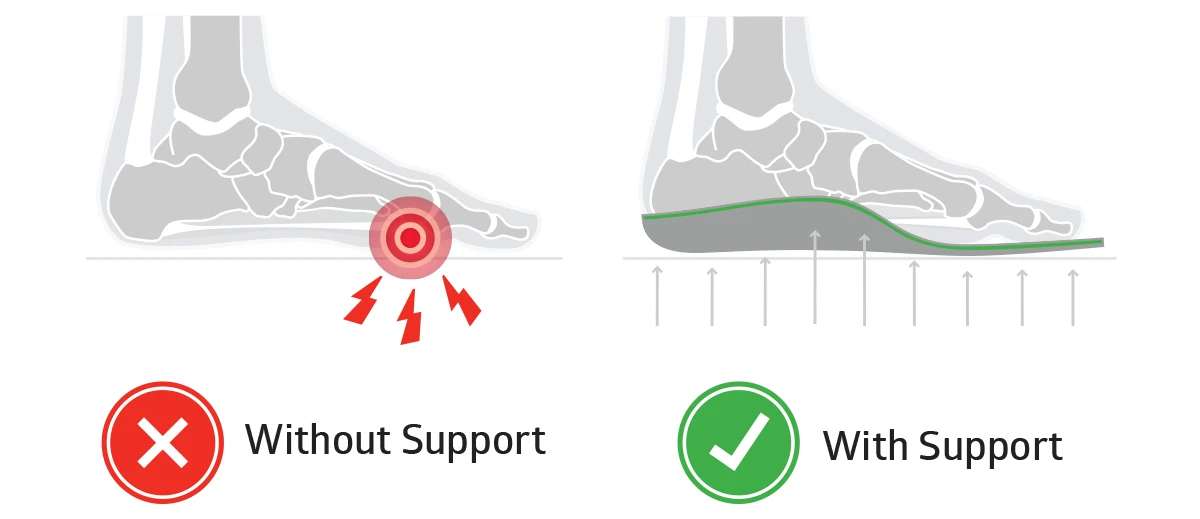 sole insoles for bunions relieve bunion pain
