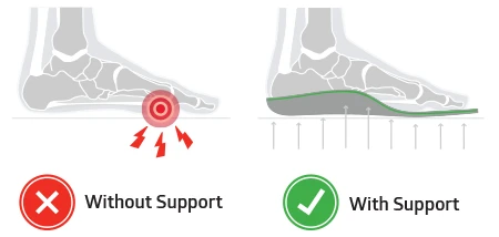 sole insoles for bunions relieve bunion pain