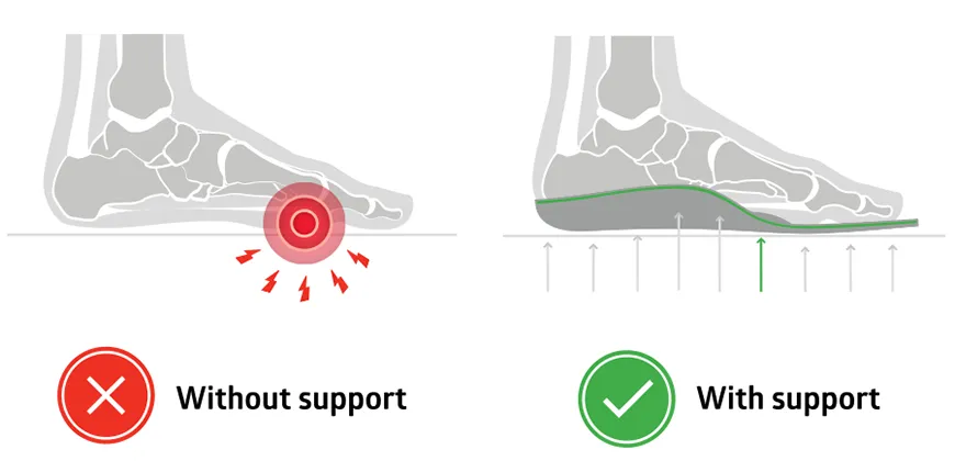 insoles with built-in metatarsal pads for mortons neuroma