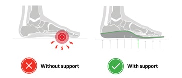 insoles with metatarsal pads relieve metatarsalgia pain