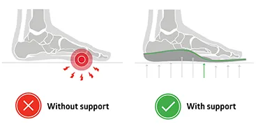 insoles with built-in metatarsal pads for mortons neuroma