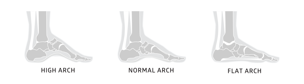 Arch Support, Flat Feet Arch Support Women and Men- Plantar