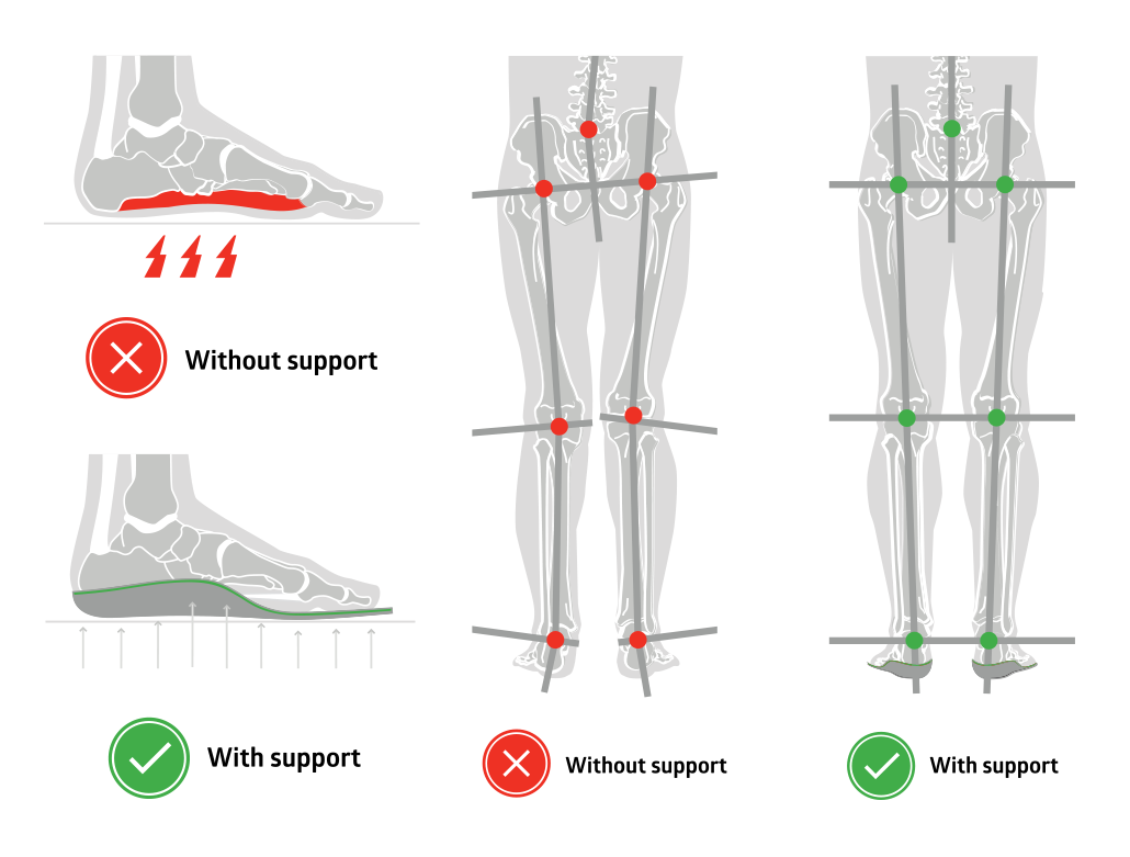 Insole foot deals pain