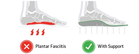 the best insoles for plantar fasciitis