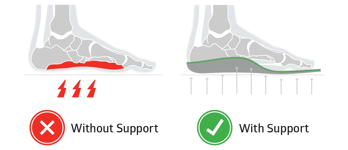 sole insoles for cycling plantar fasciitis