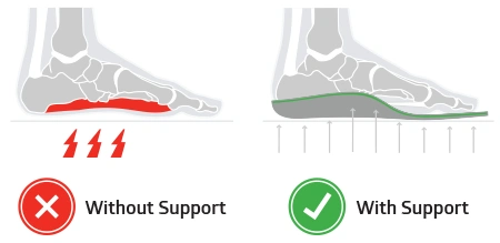 sole insoles for cycling plantar fasciitis