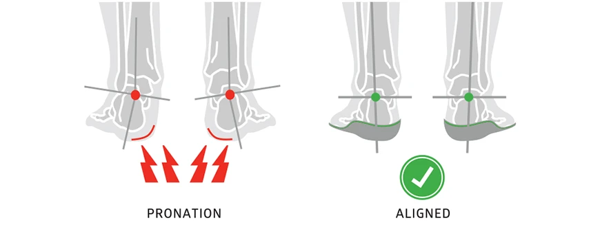 sole insoles prevent pronation in figure skates