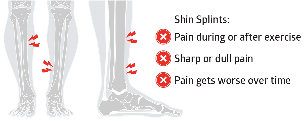 diagram indicating where shin splint pain occurs and explaining typical signs of shin splint pain