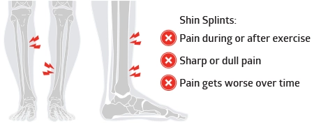 diagram indicating where shin splint pain occurs and explaining typical signs of shin splint pain