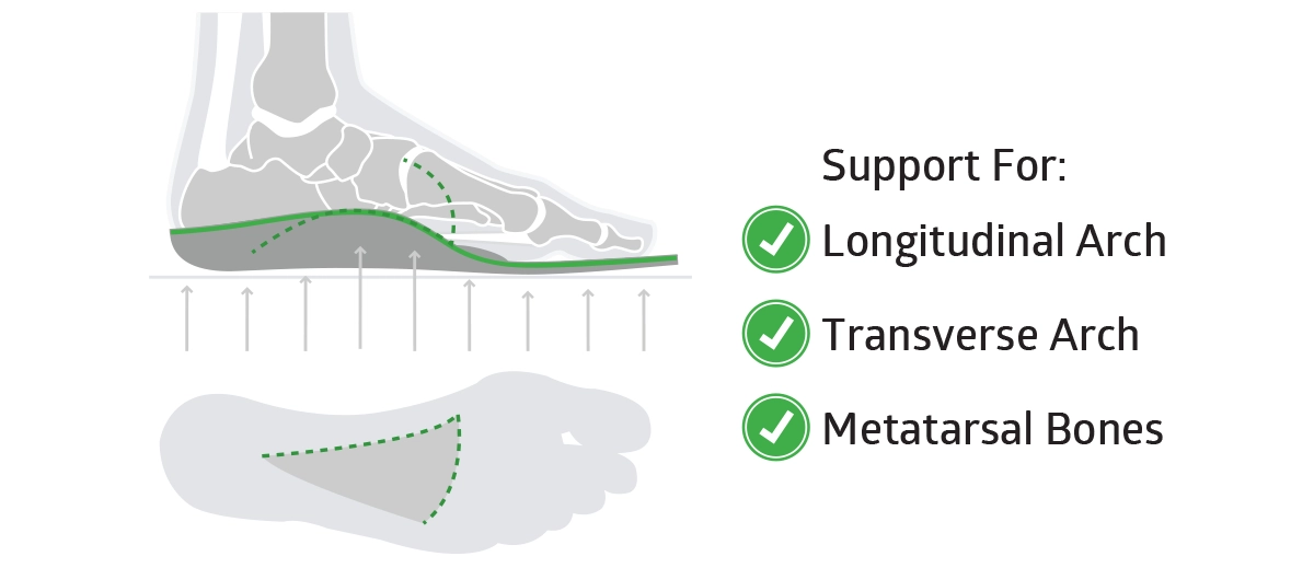 the foots transverse arch is supported by sole insoles