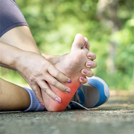 Running with 
  Plantar Fasciitis
