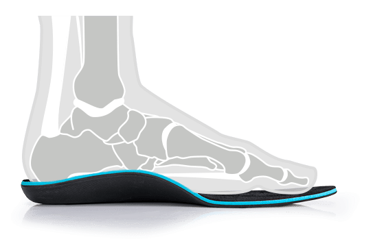 Orthopedic Insoles for Pronation: the Problem and the SOLE Solution - SOLE